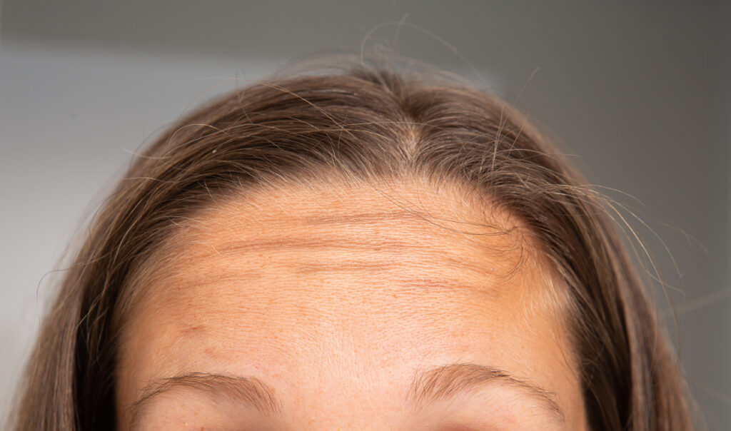Image showing wrinkles