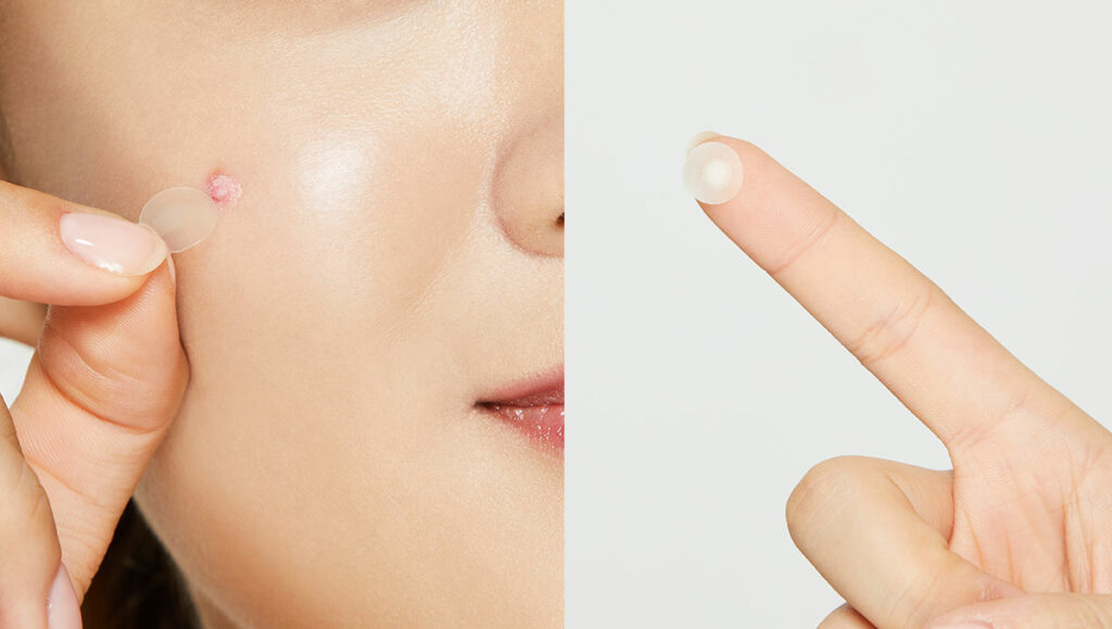 Image on the left of female applying pimple patch and visual image of pimple patch on the right